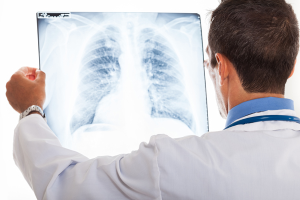 Radiografia pulmonar - Neumólogo Málaga